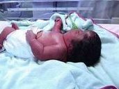 尿道炎试管婴儿（尿道炎会影响试管婴儿着床吗？）