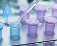 北京做试管婴儿需要多少钱？北京试管婴儿费用明细介绍