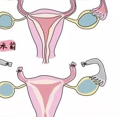 死精率80%的男性可以在沧州市做三代试管吗？公开2026做三代试管条件